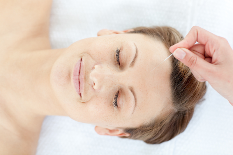 Acupuncture In Pleasanton, CA